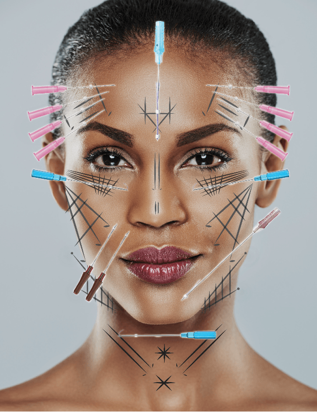 pdo thread lift patient model with treatment markings